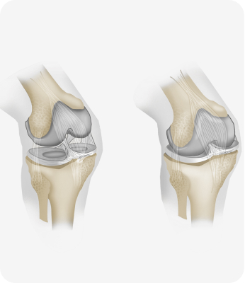Mobility